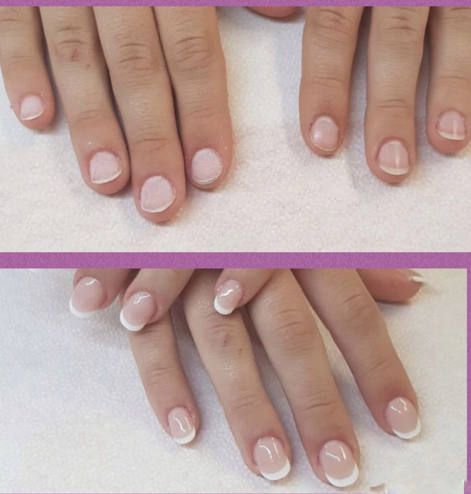 COMO ACABAR CON EL HABITO DE MORDERSE LAS UÑAS